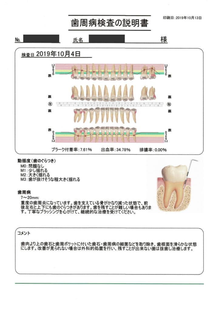 歯周病検査の説明書